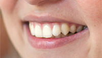 Zahnschonende Bleichmittel